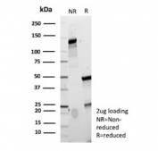 SDS-PAGE analysis of purified, BSA-free FABP5 antibody (clone CPTC-FABP5-3) as confirmation of integrity and purity.