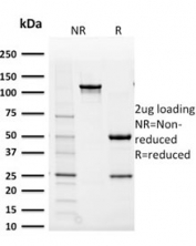 SDS-PAGE analysis of purified, BSA-free AKR1B1 antibody (clone CPTC-AKR1B1-2) as confirmation of integrity and purity.