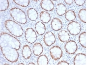IHC staining of FFPE human colon tissue with SATB2 antibody (clone SATB2/7111). HIER: boil tissue sections in pH 9 10mM Tris with 1mM EDTA for 20 min and allow to cool before testing.