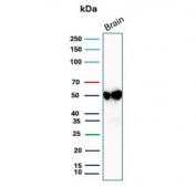Western blot testing of human brain tissue with GFAP antibody. Predicted molecular weight ~50 kDa.
