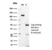 SDS-PAGE analysis of purified, BSA-free Golgi Glycoprotein 1 antibody (clone GLG1/7174R) as confirmation of integrity and purity.