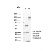 SDS-PAGE analysis of purified, BSA-free CD117 / SCFR antibody (clone C117/7119) as confirmation of integrity and purity.