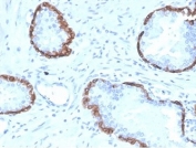 IHC staining of FFPE human prostate tissue with KRT14 antibody (clone KRT14/4128). HIER: boil tissue sections in pH 9 10mM Tris with 1mM EDTA for 20 min and allow to cool before testing.