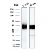 Western blot testing of human tonsil and brain tissue lysate with recombinant PDCD1 antibody. Predicted molecular weight: 32-55 kDa depending on glycosylation level.