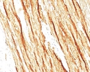 IHC staining of FFPE human colon tissue with recombinant Smoothelin antibody (clone SMTN/2320R). HIER: boil tissue sections in pH6, 10mM citrate buffer, for 20 min and allow to cool before testing.