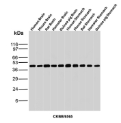 Western blot analysis of Human Brain, Mouse Brain, Rat Brain, Hamster Brain, Guinea pig Brain, Human Stomach, Mouse Stomach, Rat Stomach, Hamster Stomach and Guinea pig Stomach tissue lysates using Creatine kinase B antibody (clone CKBB/6565). Predicted molecular weight ~43 kDa.