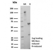 SDS-PAGE analysis of purified, BSA-free MGMT antibody (clone MGMT/8319R) as confirmation of integrity and purity.