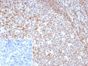 IHC staining of FFPE human tonsil tissue with MGMT antibody (clone MGMT/8319R). Inset: PBS used in place of primary Ab (secondary Ab negative control). HIER: boil tissue sections in pH 9 10mM Tris with 1mM EDTA for 20 min and allow to cool before testing.