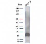 Western blot testing of human MCF7 cell lysate with MGMT antibody. Predicted molecular weight: ~23 kDa.