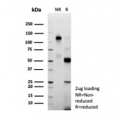 SDS-PAGE analysis of purified, BSA-free MGMT antibody (clone MGMT/8186R) as confirmation of integrity and purity.