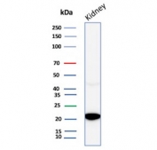 Western blot testing of human kidney tissue lysate with Crystallin Alpha B antibody (clone CRYAB/4663). Predicted molecular weight ~20 kDa.