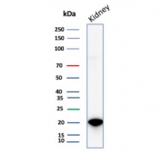 Western blot testing of human kidney tissue lysate with Crystallin Alpha B antibody (clone CRYAB/4665). Predicted molecular weight ~20 kDa.