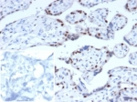 IHC staining of FFPE human placental tissue. Strong nuclear staining observed using KIP2/7187 at 2ug/ml. Inset: PBS used in place of primary Ab (secondary Ab negative control). HIER: boil tissue sections in pH 9 10mM Tris with 1mM EDTA for 20 min and allow to cool before testing.
