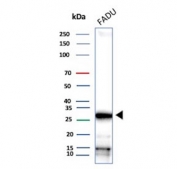 Western blot testing of human FADU cell lysate with NC2 alpha antibody. Predicted molecular weight ~22 kDa, commonly observed at 26-30 kDa.