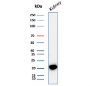 Western blot testing of human kidney tissue lysate with CRYAB antibody (clone CRYAB/4662). Predicted molecular weight ~20 kDa.