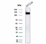 Western blot testing of human HCT-116 cell lysate with recombinant CD56 antibody. Predicted molecular weight: ~110 kDa (soluble fragment), ~120/125 kDa (GPI-anchored), 140/180 kDa (transmembrane isoforms).