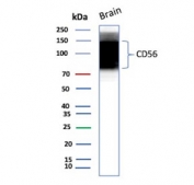 Western blot testing of human brain tissue lysate with recombinant CD56 antibody. Predicted molecular weight: ~110 kDa (soluble fragment), ~120/125 kDa (GPI-anchored), 140/180 kDa (transmembrane isoforms).