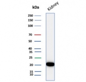 Western blot testing of human kidney tissue lysate with Crystallin Alpha B antibody (clone CRYAB/4659). Predicted molecular weight ~20 kDa.