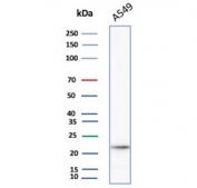 Western blot testing of human A549 cell lysate with IL-18 antibody. Predicted molecular weight ~22 kDa.