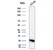 Western blot testing of human A549 cell lysate with IL-18 antibody. Predicted molecular weight ~22 kDa.
