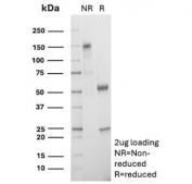 SDS-PAGE analysis of purified, BSA-free recombinant CD27 antibody (clone LPFS2/8574R) as confirmation of integrity and purity.