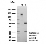 SDS-PAGE analysis of purified, BSA-free NSE Gamma antibody (clone ENO/8632R) as confirmation of integrity and purity.