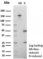 SDS-PAGE analysis of purified, BSA-free Alpha-2M antibody (clone A2M/6556) as confirmation of integrity and purity.