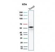 Western blot testing of human tonsil tissue lysate with recombinant CD4 antibody. Expected molecular weight: 50-55 kDa.