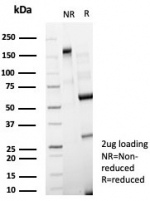SDS-PAGE analysis of purified, BSA-free CD63 antibody (clone LAMP3/8248R) as confirmation of integrity and purity.