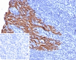 IHC staining of FFPE human tonsil tissue with recombinant KRT5 antibody (clone rKRT5/6969). Inset: PBS used in place of primary Ab (secondary Ab negative control). HIER: boil tissue sections in pH 9 10mM Tris with 1mM EDTA for 20 min and allow to cool before testing.
