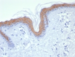 IHC staining of FFPE human skin tissue with Cytokeratin 1 antibody (clone KRT1/8342R). HIER: boil tissue sections in pH 9 10mM Tris with 1mM EDTA for 20 min and allow to cool before testing.
