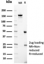 SDS-PAGE analysis of purified, BSA-free IgD Heavy Chain antibody (clone IGHD/4967) as confirmation of integrity and purity.