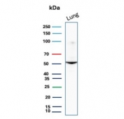 Western blot testing of human lung tissue lysate with AAT antibody. Expected molecular weight: 47-52 kDa depending on the level of glycosylation.
