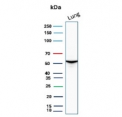 Western blot testing of human lung tissue lysate with AAT antibody. Expected molecular weight: 47-52 kDa depending on the level of glycosylation.