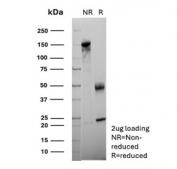 SDS-PAGE analysis of purified, BSA-free AAT antibody (clone AAT/4486) as confirmation of integrity and purity.