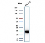 Western blot testing of human MCF7 cell lysate with Galectin 3 antibody (clone LGALS3/6583). Predicted molecular weight ~26 kDa.