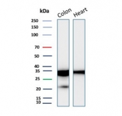 Western blot testing of human colon and heart tissue lysate with Galectin 3 antibody (clone LGALS3/6583). Predicted molecular weight ~26 kDa.