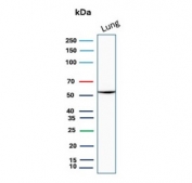 Western blot testing of human lung tissue lysate with SERPINA1 antibody. Expected molecular weight: 47-52 kDa depending on the level of glycosylation.