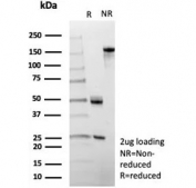 SDS-PAGE analysis of purified, BSA-free SERPINA1 antibody (clone AAT/4613) as confirmation of integrity and purity.