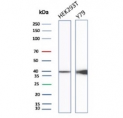 Western blot testing of human HEK293 and Y79 cell lysate with recombinant CKB antibody. Predicted molecular weight ~43 kDa.
