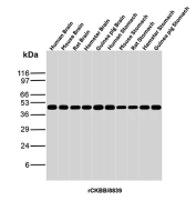 Western blot analysis of Human Brain, Mouse Brain, Rat Brain, Hamster Brain, Guinea pig Brain, Human Stomach, Mouse Stomach, Rat Stomach, Hamster Stomach and Guinea pig Stomach tissue lysates using Recombinant CKB antibody (clone rCKBB/8839). Predicted molecular weight ~43 kDa.