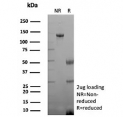 SDS-PAGE analysis of purified, BSA-free recombinant CKBB antibody (clone rCKBB/8844) as confirmation of integrity and purity.