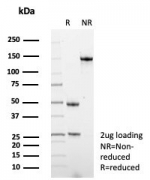 SDS-PAGE analysis of purified, BSA-free Alpha-1-Antitrypsin Mouse Monoclonal (AAT/4490) as confirmation of integrity and purity.