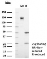 SDS-PAGE analysis of purified, BSA-free Alpha-1-Antitrypsin Mouse Monoclonal (AAT/4571) as confirmation of integrity and purity.