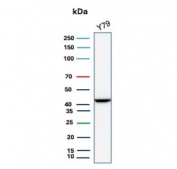 Western blot testing of human Y79 cell lysate with Creatine kinase B antibody (clone CKBB/6566). Predicted molecular weight ~43 kDa.