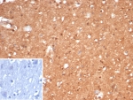IHC staining of FFPE human brain tissue with Brain Creatine Kinase antibody (clone CKBB/6568). Inset: PBS used in place of primary Ab (secondary Ab negative control). HIER: boil tissue sections in pH 9 10mM Tris with 1mM EDTA for 20 min and allow to cool before testing.