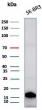 Western blot testing of human SK-BR-3 cell lysate with GCHFR antibody (clone GCHFR/7734). Predicted molecular weight ~10 kDa.
