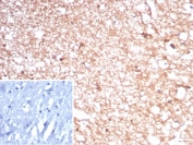 IHC staining of FFPE human brain tissue with recombinant Creatine kinase B antibody (clone rCKBB/8841). Inset: PBS used in place of primary Ab (secondary Ab negative control). HIER: boil tissue sections in pH 9 10mM Tris with 1mM EDTA for 20 min and allow to cool before testing.