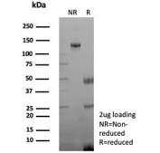 SDS-PAGE analysis of purified, BSA-free recombinant Creatine kinase B antibody (clone rCKBB/8841) as confirmation of integrity and purity.