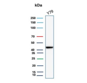 Western blot testing of human Y79 cell lysate with recombinant Creatine kinase B antibody. Predicted molecular weight ~43 kDa.